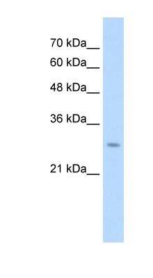 Western Blot: UBE2J2/UBC6 Antibody [NBP1-59760]