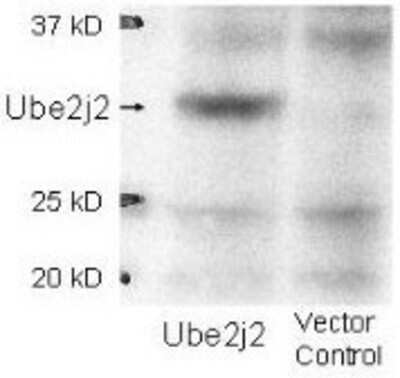 Western Blot: UBE2J2/UBC6 Antibody [NBP1-78071]