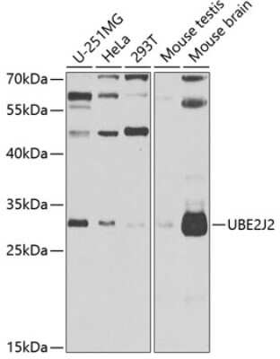 Western Blot: UBE2J2/UBC6 AntibodyBSA Free [NBP2-93049]