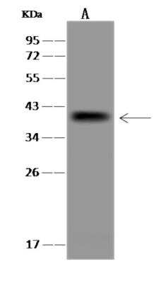 Western Blot: UBE2J2/UBC6 Antibody [NBP3-06347]