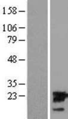 Western Blot: UBE2M/Ubc12 Overexpression Lysate [NBL1-17540]