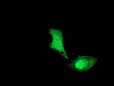 Immunocytochemistry/ Immunofluorescence: UBE2M/Ubc12 Antibody (OTI2D9) [NBP2-01377]