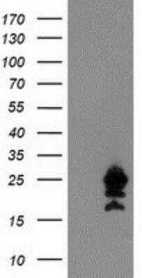 Western Blot: UBE2M/Ubc12 Antibody (OTI2D9) [NBP2-01377]