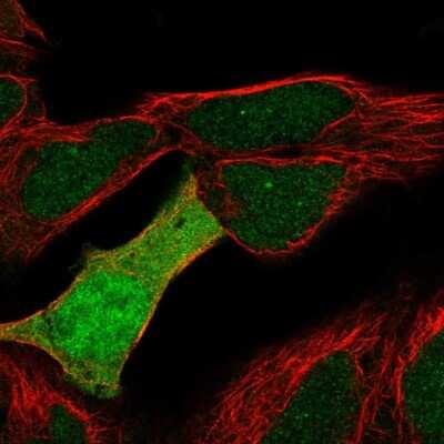 Immunocytochemistry/ Immunofluorescence: UBE2M/Ubc12 Antibody [NBP2-49137]