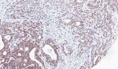 Immunohistochemistry-Paraffin: UBE2M/Ubc12 Antibody [NBP1-31459]