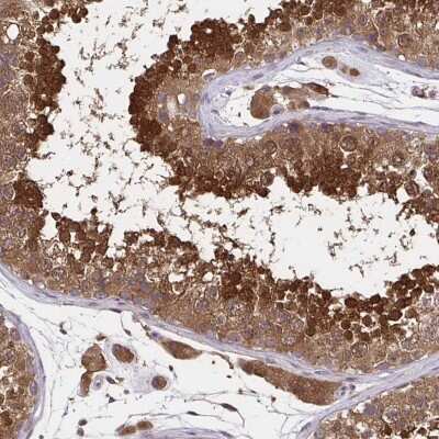 Immunohistochemistry-Paraffin: UBE2M/Ubc12 Antibody [NBP2-49137]