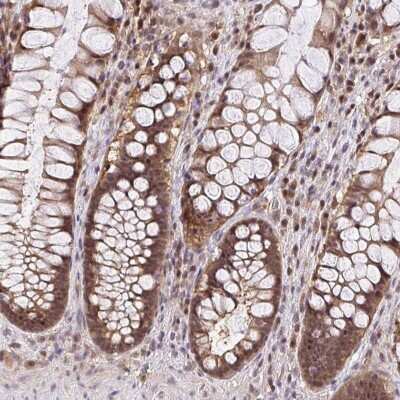 Immunohistochemistry-Paraffin: UBE2M/Ubc12 Antibody [NBP2-49268]