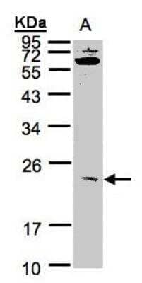 Western Blot: UBE2M/Ubc12 Antibody [NBP1-31459]