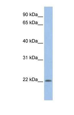 Western Blot: UBE2M/Ubc12 Antibody [NBP1-55035]