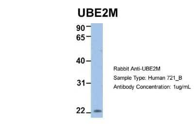 Western Blot: UBE2M/Ubc12 Antibody [NBP1-55035]