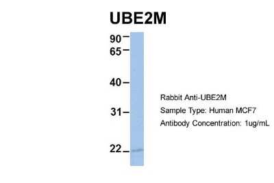 Western Blot: UBE2M/Ubc12 Antibody [NBP1-55035]