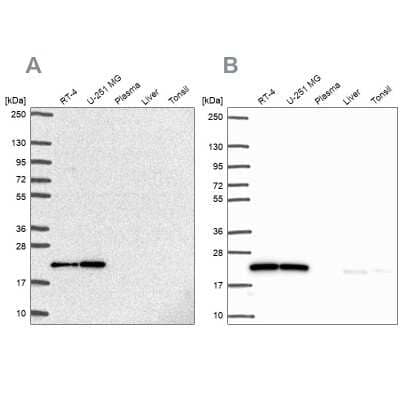 Western Blot: UBE2M/Ubc12 Antibody [NBP2-49137]