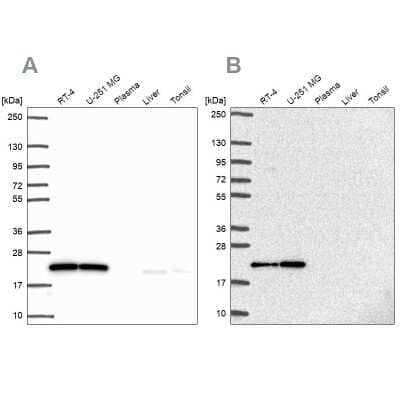 Western Blot: UBE2M/Ubc12 Antibody [NBP2-49268]