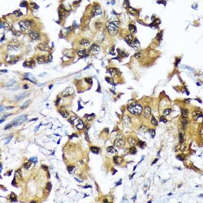 Immunohistochemistry-Paraffin: UBE2N/Ubc13 Antibody (10O9Z5) [NBP3-16793]
