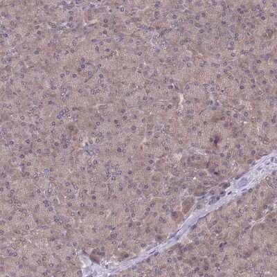 Immunohistochemistry-Paraffin: UBE2N/Ubc13 Antibody [NBP2-48823]