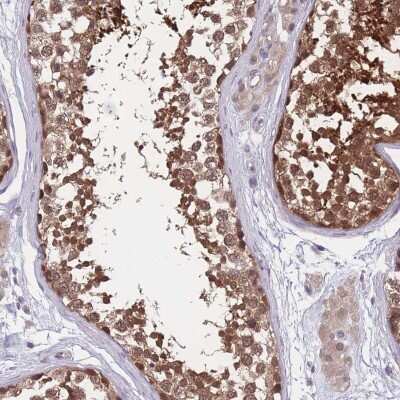 Immunohistochemistry-Paraffin: UBE2N/Ubc13 Antibody [NBP2-48823]