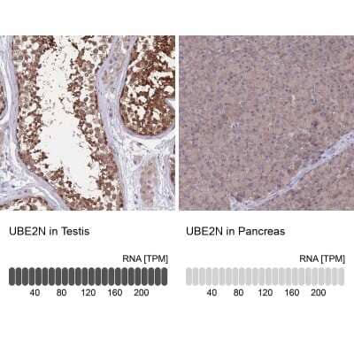 Immunohistochemistry-Paraffin: UBE2N/Ubc13 Antibody [NBP2-48823]