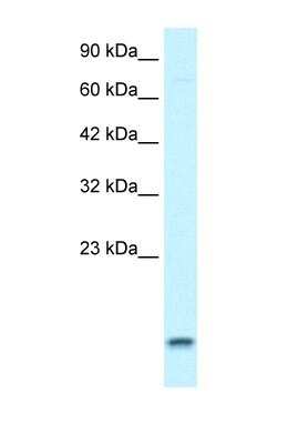 Western Blot: UBE2N/Ubc13 Antibody [NBP1-55027]