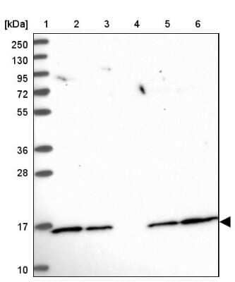 Western Blot: UBE2N/Ubc13 Antibody [NBP2-48823]