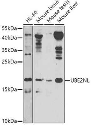 Western Blot: UBE2NL AntibodyBSA Free [NBP3-05571]