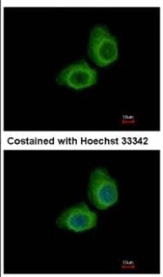 Immunocytochemistry/ Immunofluorescence: UBE2O Antibody [NBP2-20787]