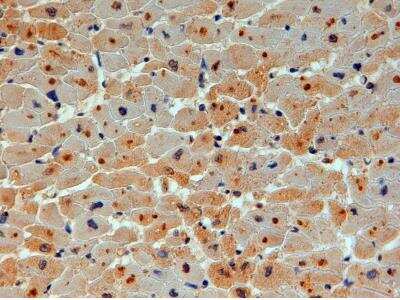 Immunohistochemistry-Paraffin: UBE2O Antibody [NB100-1149]