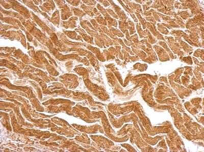 Immunohistochemistry-Paraffin: UBE2O Antibody [NBP2-20787]