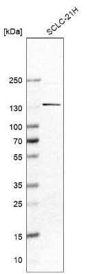 Western Blot: UBE2O Antibody [NBP2-13501]