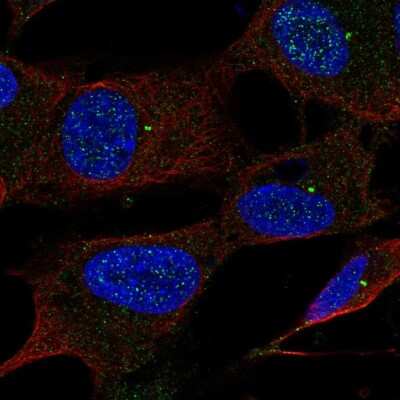 Immunocytochemistry/ Immunofluorescence: UBE2Q1 Antibody [NBP2-49394]