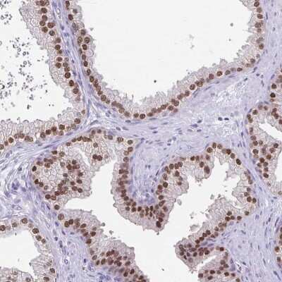 Immunohistochemistry-Paraffin: UBE2Q1 Antibody [NBP2-49394]