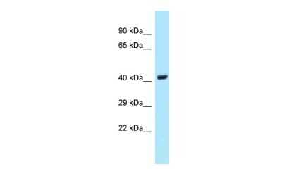 Western Blot: UBE2Q1 Antibody [NBP2-83732]