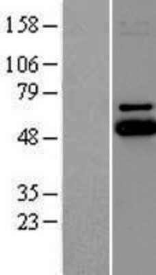 Western Blot: UBE2Q1 Overexpression Lysate [NBP2-06958]