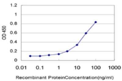 ELISA: UBE2Q2 Antibody (2H3) [H00092912-M04]