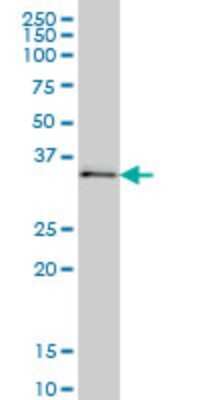 Western Blot: UBE2Q2 Antibody (2H3) [H00092912-M04]