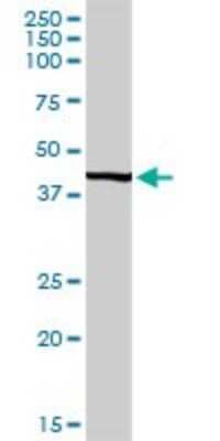 Western Blot: UBE2Q2 Antibody [H00092912-D01P]