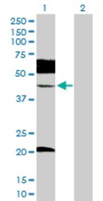 Western Blot: UBE2Q2 Antibody [H00092912-D01P]