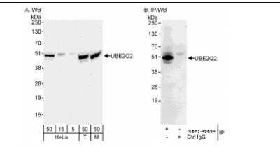 Western Blot: UBE2Q2 Antibody [NBP1-49694]