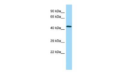 Western Blot: UBE2Q2 Antibody [NBP2-82369]