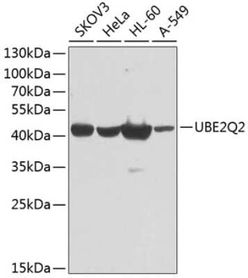 Western Blot: UBE2Q2 AntibodyBSA Free [NBP2-94350]