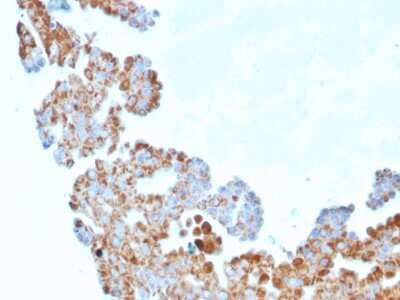 Immunohistochemistry-Paraffin: UBE2R1/CDC34 Antibody (CPTC-CDC34-2) [NBP3-07514]