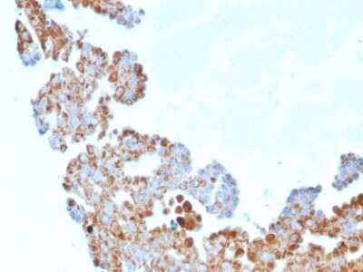 Immunohistochemistry-Paraffin: UBE2R1/CDC34 Antibody (CPTC-CDC34-2) - Azide and BSA Free [NBP3-08839]