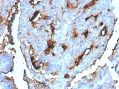 Immunohistochemistry-Paraffin: UBE2R1/CDC34 Antibody (CPTC-CDC34-2) - Azide and BSA Free [NBP3-08839]