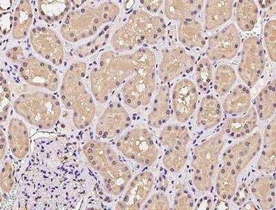 Immunohistochemistry-Paraffin: UBE2R1/CDC34 Antibody [NBP3-06560]