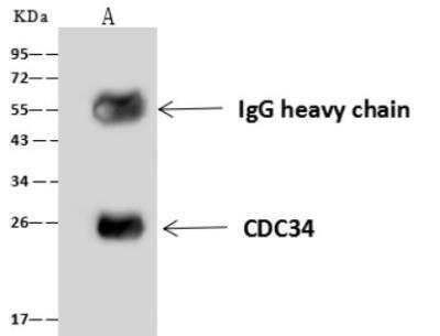 Immunoprecipitation: UBE2R1/CDC34 Antibody [NBP3-06560]