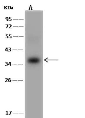 Western Blot: UBE2R1/CDC34 Antibody [NBP3-06560]