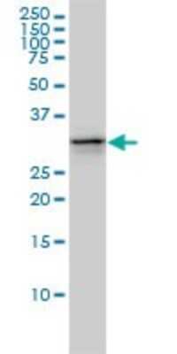 Western Blot: UBE2R2 Antibody (5E7) [H00054926-M01]