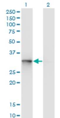 Western Blot: UBE2R2 Antibody (5E7) [H00054926-M01]