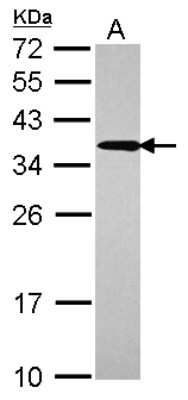 Western Blot: UBE2R2 Antibody [NBP2-15154]