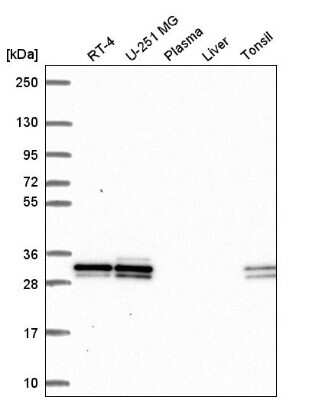 Western Blot: UBE2R2 Antibody [NBP2-57527]