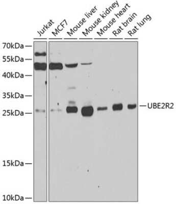 Western Blot: UBE2R2 AntibodyBSA Free [NBP2-93070]